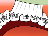 Brushing Step 1