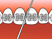 Flossing Step 2