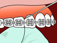 Flossing Step 3