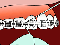 Flossing Step 4
