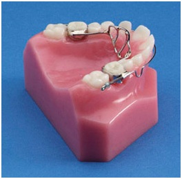Thumb - Finger Habit Appliance